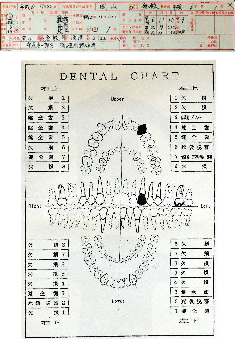 00004199411
