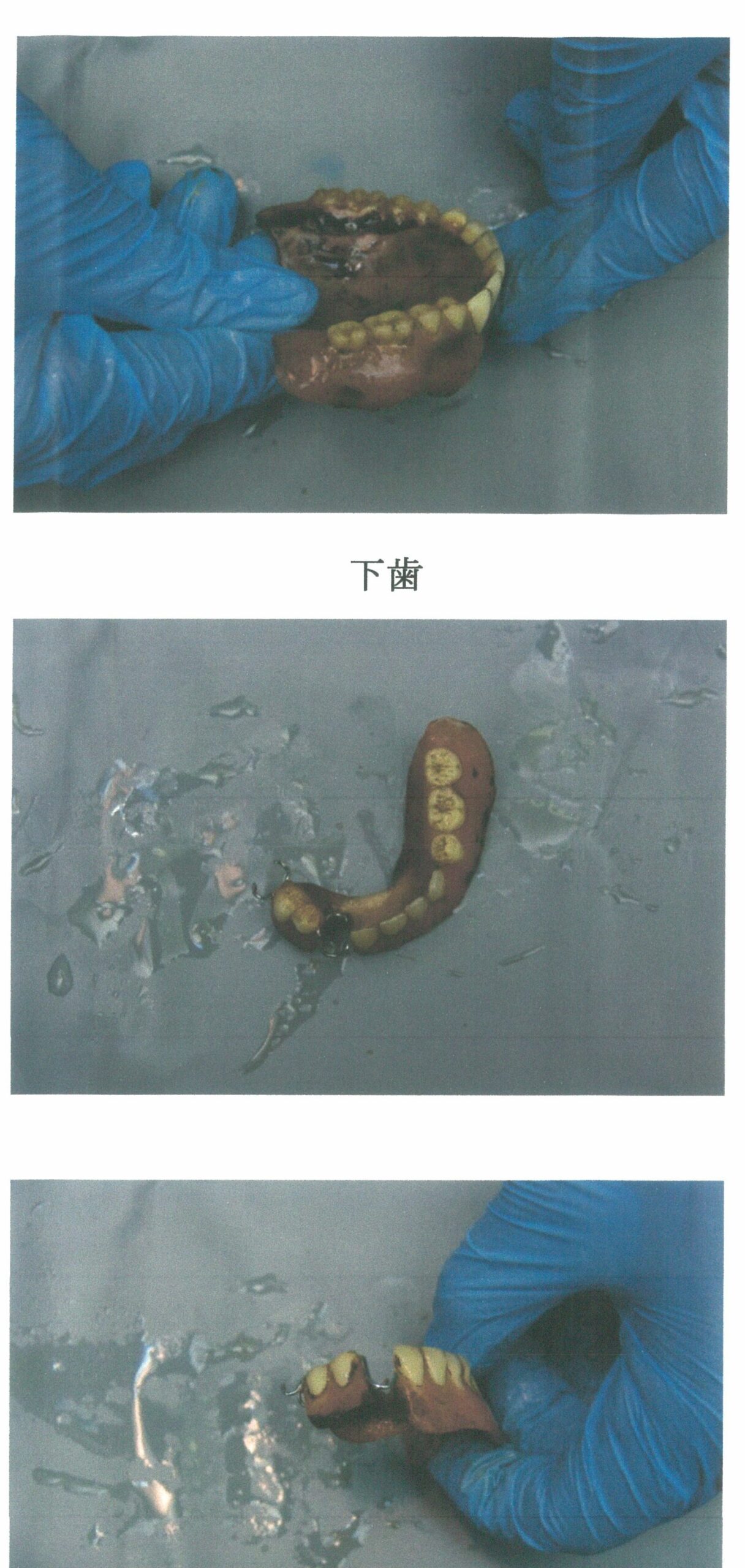 scan-141-3