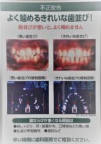 ②10-1　よく噛めるきれいな歯並び！